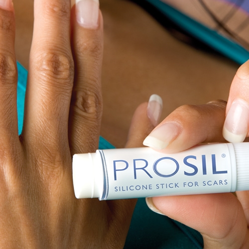Prosil Stick con gel de silicona para pequeñas cicatrices