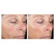 Deesse Pro Express mascarilla LED