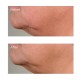 PERRICONE MD Hight Potency Gorwth Factor Firming & Lifting Serum 59ml