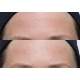 PERRICONE MD Neuropeptide Facial Cream 74ml