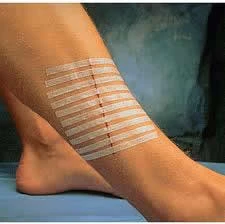 Biodermis ante una mala cicatrización