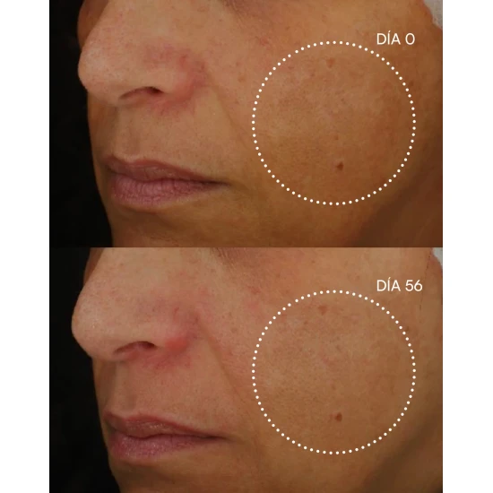 GH 2000 RETINAL-R SERUM 30 ML