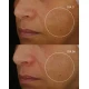 GH 2000 RETINAL-R SERUM 30 ML