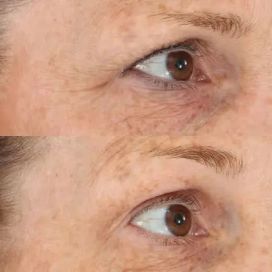 PERRICONE MD Essential Fx Acyl-Glutathione Eyelid Lift Serum 15ml