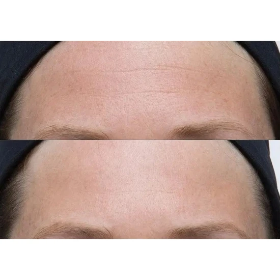 PERRICONE MD Neuropeptide Facial Cream 74ml