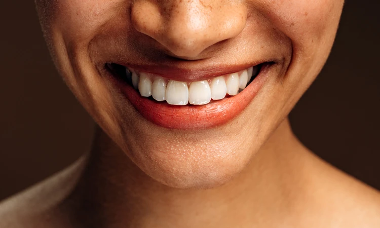 HOMEODENT dientes sanos